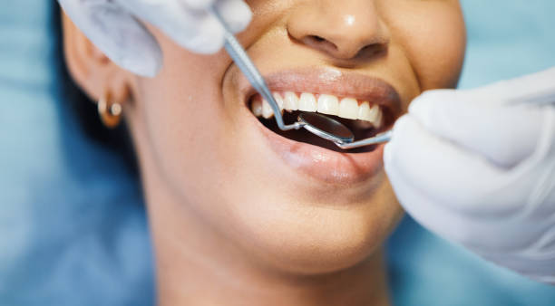 Best Urgent Care for Lost Fillings or Crowns in Tahoma, CA