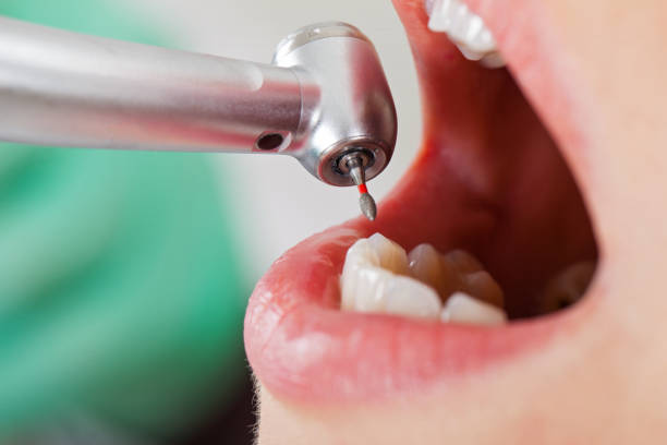 Best Same-Day Emergency Dental Services in Tahoma, CA